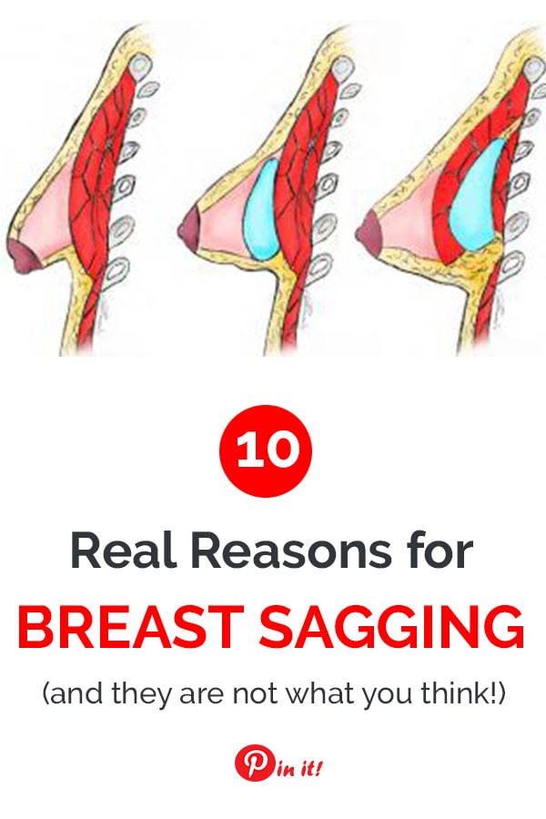 10 real reasons for breast sagging (and they are not what you think!). What causes breast ptosis and the right strategies to dealing with it. Learn how to postpone aging of your skin and avoid saggy breasts after pregnancy and breastfeeding.