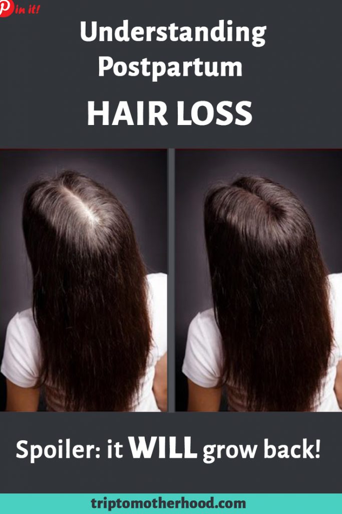 Postpartum Hair Loss The Truth Best Treatments To Make