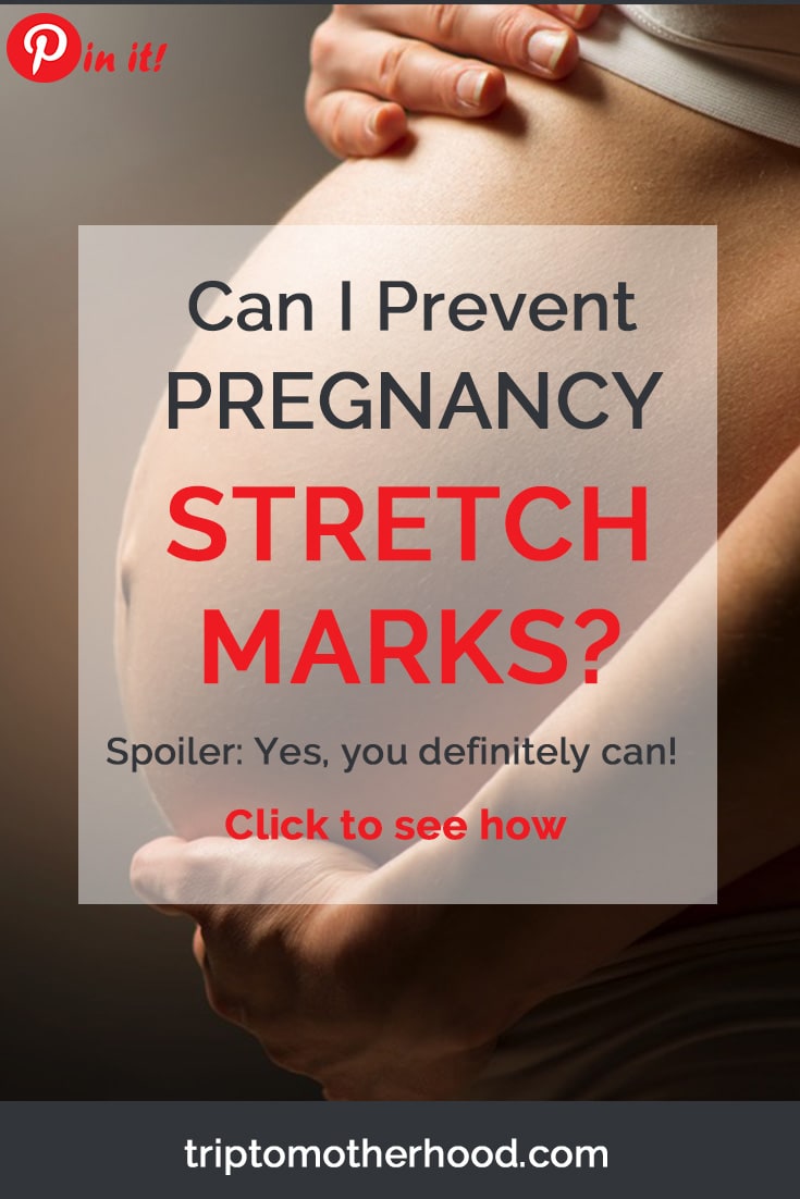 How To Prevent Pregnancy Stretch Marks 10 Easy Steps That Work 4933